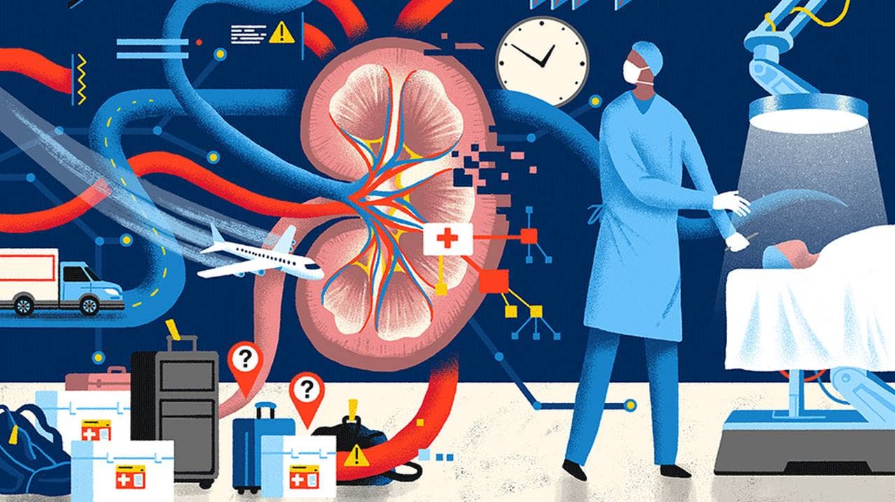 organ-tracking-kidney