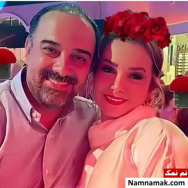 برزو ارجمند و همسرش بع از کاشت مو